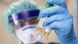 В украинских лабораториях появятся тесты на выявление коронавируса COVID-19