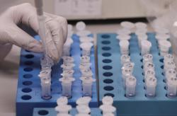 В Украине достаточное количество тест-систем для выявления коронавируса