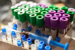 Киевщина получила 5,9 тысячи экспресс-тестов на коронавирус - ОГА