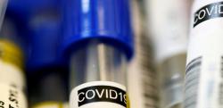 В Украине начали лицензировать изготовление препаратов для борьбы с COVID-19