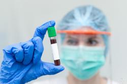 За сутки в Украине коронавирус обнаружен у 107 медиков