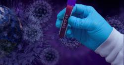 Украина прошла пик эпидемии коронавируса COVID-19 - НАН