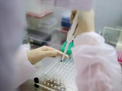 В Украине с начала эпидемии COVID-19 сделали 877 тысяч тестов на коронавирус