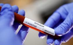 Минздрав провел рекордное количество тестов на коронавирус за сутки