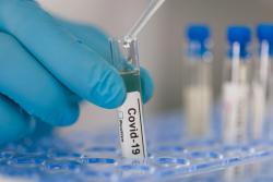 Врачам семейной медицины и мобильным бригадам будут предоставлены новые экспресс-тесты на антиген COVID-19
