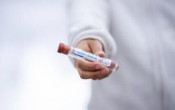 Украина получит от США инновационные лекарства против коронавируса